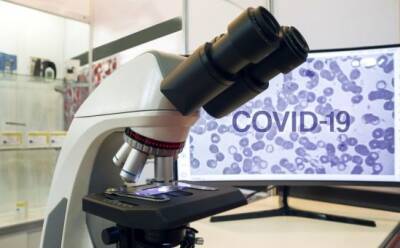 На Кипр придут новые препараты от COVID-19 - vkcyprus.com - Кипр - Франция