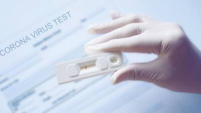 Пункты экспресс-тестирования на антигены 1 декабря - kiprinform.com - Cyprus