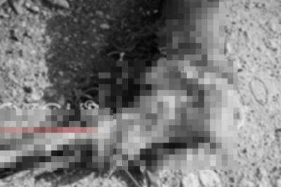 На северном Кипре в мусорном пакете нашли отрубленную человеческую ногу - cyprusbutterfly.com.cy - Кипр