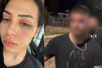 В Айя-Напе избили девушку, приехавшую на отдых из ТРСК - cyprusbutterfly.com.cy - Никосия - Греция - Фамагуста